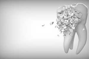 wisdom tooth extraction cost in india