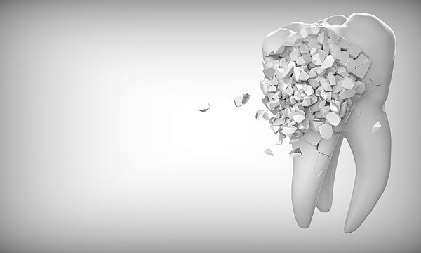 wisdom tooth extraction cost in india